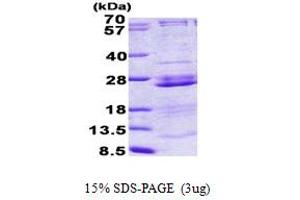 SDS-PAGE (SDS) image for Ribosomal Protein L23A (RPL23A) (AA 1-156) protein (His tag) (ABIN5852978) (RPL23A Protein (AA 1-156) (His tag))