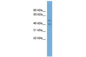 Western Blot showing INHBA antibody used at a concentration of 1-2 ug/ml to detect its target protein. (INHBA 抗体  (N-Term))