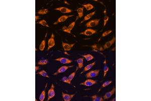 Immunofluorescence analysis of L929 cells using MMP25 antibody (ABIN3023456, ABIN3023457, ABIN3023458 and ABIN6220000) at dilution of 1:100. (MMP25 抗体)