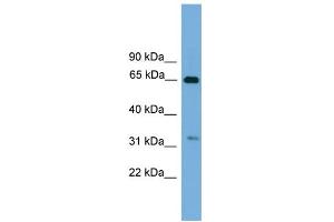 WB Suggested Anti-UBXD3 Antibody Titration: 0. (UBXN10 抗体  (Middle Region))