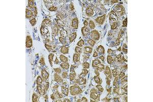 Immunohistochemistry of paraffin-embedded human stomach using UQCRC1 antibody (ABIN5971722) at dilution of 1/100 (40x lens). (UQCRC1 抗体)