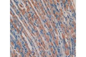 Used in DAB staining on fromalin fixed paraffin- embedded stomach tissue (Chemerin 抗体  (AA 21-155))