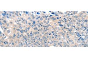 Immunohistochemistry (Paraffin-embedded Sections) (IHC (p)) image for anti-Solute Carrier Family 17 (Vesicular Glutamate Transporter), Member 6 (SLC17A6) antibody (ABIN7254220)