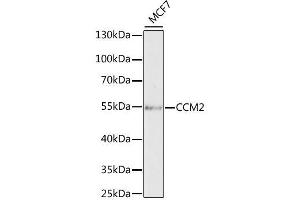 Western blot analysis of extracts of MCF7 cells, using CCM2 antibody. (CCM2 抗体  (AA 1-300))