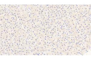 Immunohistochemistry (IHC) image for anti-Aconitase 1 (ACO1) (AA 251-443) antibody (ABIN7438541)