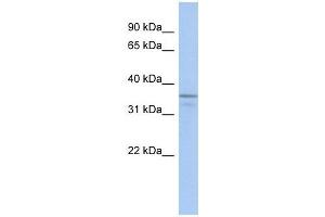 UBLCP1 antibody used at 1 ug/ml to detect target protein. (UBLCP1 抗体  (N-Term))
