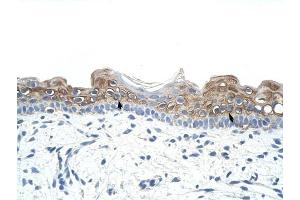 DAZ2 antibody was used for immunohistochemistry at a concentration of 4-8 ug/ml to stain Squamous epithelial cells (arrows) in Human Skin. (DAZ2 抗体  (N-Term))