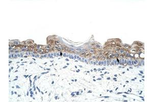 DAZ2 antibody was used for immunohistochemistry at a concentration of 4-8 ug/ml to stain Squamous epithelial cells (arrows) in Human Skin.