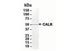 Western Blotting (WB) image for Calreticulin (CALR) (AA 18-417) protein (ABIN2468306) (Calreticulin Protein (CALR) (AA 18-417))