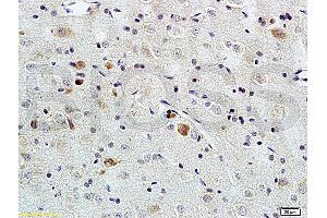 Formalin-fixed and paraffin embedded rat brain tissue labeled with Rabbit Anti-PACAP-38 Polyclonal Antibody (ABIN726215), Unconjugated at 1:200 followed by conjugation to the secondary antibody and DAB staining. (PACAP-38 抗体  (AA 31-38))
