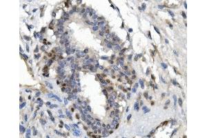 IHC analysis of FOXP1 using anti-FOXP1 antibody (ABIN7602780). (FOXP1 抗体  (C-Term))