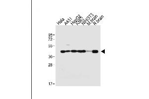 All lanes : Anti-TARDBP Antibody (N-term) at 1:2000 dilution Lane 1: Hela whole cell lysate Lane 2: A431 whole cell lysate Lane 3: HepG2 whole cell lysate Lane 4: K562 whole cell lysate Lane 5: NIH/3T3 whole cell lysate Lane 6: Mouse brain tissue lysate Lane 7: Rat brain tissue lysate Lysates/proteins at 20 μg per lane. (TARDBP 抗体  (N-Term))