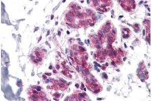 Human Breast: Formalin-Fixed, Paraffin-Embedded (FFPE) (CDC27 抗体  (C-Term))