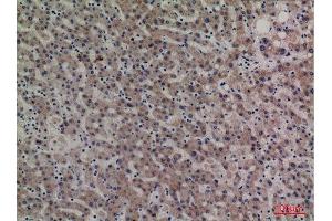 Immunohistochemistry (IHC) image for anti-serpin Peptidase Inhibitor, Clade A (Alpha-1 Antiproteinase, Antitrypsin), Member 4 (SERPINA4) (Internal Region) antibody (ABIN6281470)