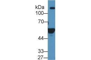 Western blot analysis of Human K562 cell lysate, using Human ALDH1A2 Antibody (1 µg/ml) and HRP-conjugated Goat Anti-Rabbit antibody ( (ALDH1A2 抗体  (AA 1-422))