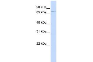Western Blotting (WB) image for anti-ATP-Binding Cassette, Sub-Family B (MDR/TAP), Member 8 (ABCB8) (Middle Region) antibody (ABIN2781518)
