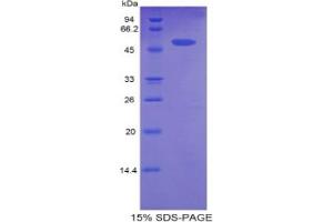 SDS-PAGE analysis of Rat CPT1A Protein. (CPT1A 蛋白)