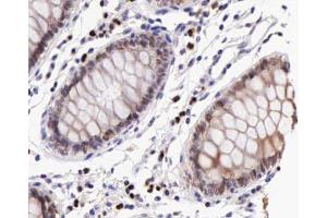 Immunohistochemistry (IHC) image for anti-Inhibitor of kappa Light Polypeptide Gene Enhancer in B-Cells, Kinase beta (IKBKB) (pTyr199) antibody (ABIN6256667)