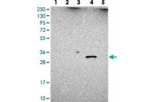 Western blot analysis of Lane 1: RT-4, Lane 2: U-251 MG, Lane 3: Human Plasma, Lane 4: Liver, Lane 5: Tonsil with UTP23 polyclonal antibody  at 1:250-1:500 dilution. (UTP23 抗体)