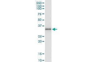 Immunoprecipitation of PIM2 transfected lysate using anti-PIM2 MaxPab rabbit polyclonal antibody and Protein A Magnetic Bead , and immunoblotted with PIM2 purified MaxPab mouse polyclonal antibody (B01P) . (PIM2 抗体  (AA 1-311))
