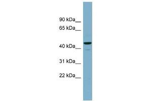 CANT1 antibody used at 1 ug/ml to detect target protein. (CANT1 抗体  (Middle Region))