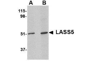 Image no. 1 for anti-LAG1 Homolog, Ceramide Synthase 5 (LASS5) (N-Term) antibody (ABIN341704) (LASS5 抗体  (N-Term))
