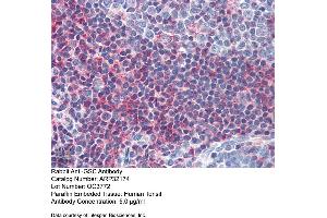 Immunohistochemistry with Human Tonsil lysate tissue at an antibody concentration of 5. (GSC 抗体  (N-Term))