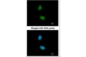 ICC/IF Image Immunofluorescence analysis of paraformaldehyde-fixed HeLa, using ZNF134, antibody at 1:200 dilution. (ZNF134 抗体)
