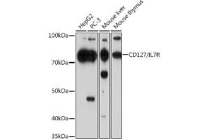 Western blot analysis of extracts of various cell lines, using CD127/IL7R Rabbit mAb (ABIN7268005) at 1:1000 dilution. (IL7R 抗体)