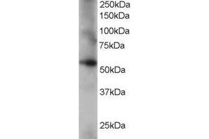 Western Blotting (WB) image for anti-Coronin, Actin Binding Protein, 1C (CORO1C) (C-Term) antibody (ABIN2465550) (CORO1C 抗体  (C-Term))