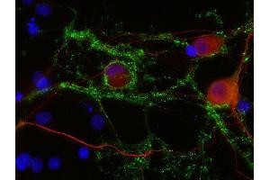 Indirect immunostaining of PFA fixed rat hippocampus neurons with anti-Neurofilament L (dilution 1 : 500; red) and mouse anti-Synapsin 1 (cat. (NEFL 抗体  (AA 1-284))