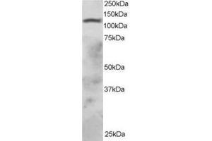 Image no. 1 for anti-Ring Finger Protein 31 (RNF31) (C-Term) antibody (ABIN374257) (RNF31 抗体  (C-Term))