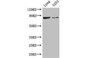 Western Blot Positive WB detected in: Mouse lung tissue, U251 whole cell lysate All lanes: YTHDC1 antibody at 3. (YTHDC1 抗体  (AA 89-153))