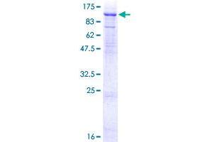 SDS-PAGE (SDS) image for NIMA-Related Kinase 8 (NEK8) (AA 1-692) protein (GST tag) (ABIN1802929) (NEK8 Protein (AA 1-692) (GST tag))