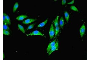 Immunofluorescent analysis of Hela cells using ABIN7159700 at dilution of 1:100 and Alexa Fluor 488-congugated AffiniPure Goat Anti-Rabbit IgG(H+L) (MCPH1 抗体  (AA 536-835))