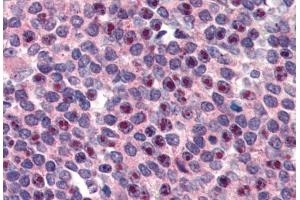 Immunohistochemistry (IHC) image for anti-Fanconi Anemia Complementation Group G (FANCG) (C-Term) antibody (ABIN190919)