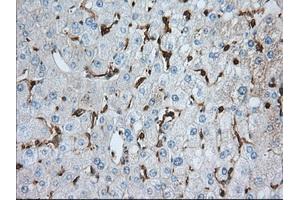 Immunohistochemical staining of paraffin-embedded prostate tissue using anti-ALDH3A1 mouse monoclonal antibody. (ALDH3A1 抗体)