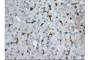 Immunohistochemical staining of paraffin-embedded prostate tissue using anti-ALDH3A1 mouse monoclonal antibody.