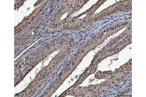 IHC analysis of PC4/SUB1 using anti-PC4/SUB1 antibody (ABIN4886733).