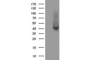 Western Blotting (WB) image for anti-Tubulin Folding Cofactor C (TBCC) antibody (ABIN1501323) (TBCC 抗体)