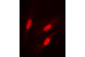 Immunofluorescent analysis of Beta-catenin (pS37) staining in HeLa cells. (beta Catenin 抗体  (N-Term, pSer37))