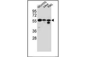 Western blot analysis of FOXN2 / HTLF Antibody (N-term) in NCI-H292, Jurkat, K562 cell line lysates (35ug/lane). (FOXN2 抗体  (N-Term))