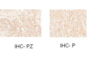 Sample Type:  Human Optic Nerve and Spinal CordCellular Target: Oligoden Drocyte Lineage cells   Dilution:  1:1000 (MYT1 抗体  (N-Term))