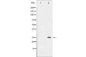 Western blot analysis of TNNI3 phosphorylation expression in Jurkat whole cell lysates,The lane on the left is treated with the antigen-specific peptide. (TNNI3 抗体  (pSer44))