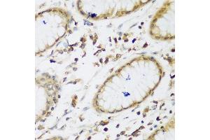 Immunohistochemistry of paraffin-embedded human gastric using UBE3A antibody at dilution of 1:200 (40x lens). (ube3a 抗体)