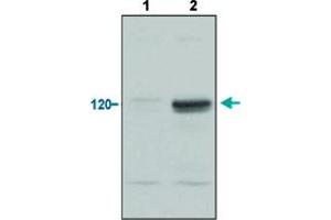 Western Blot analysis of (1) normoxic and (2) hypoxic nuclear rat cell lysates with EPAS1 polyclonal antibody . (EPAS1 抗体  (C-Term))