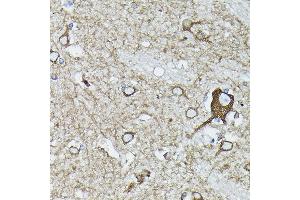 Immunohistochemistry of paraffin-embedded human brain using [KO Validated] Calreticulineticulin Rabbit pAb (ABIN3021344, ABIN3021345, ABIN3021346 and ABIN6214923) at dilution of 1:100 (40x lens). (Calreticulin 抗体)