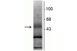 Western blot of rat hippocampal lysate showing specific immunolabeling of the ~48 kDa RAR-β isotype. (Retinoic Acid Receptor beta 抗体  (N-Term))