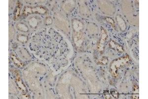 Image no. 2 for anti-Calmodulin-Like 5 (CALML5) (AA 1-147) antibody (ABIN599566) (CALML5 抗体  (AA 1-147))