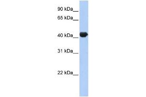 WB Suggested Anti-ZNF3 Antibody Titration:  0. (ZNF3 抗体  (N-Term))